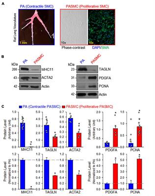 Upregulation of Calcium Homeostasis Modulators in Contractile-To-Proliferative Phenotypical Transition of Pulmonary Arterial Smooth Muscle Cells